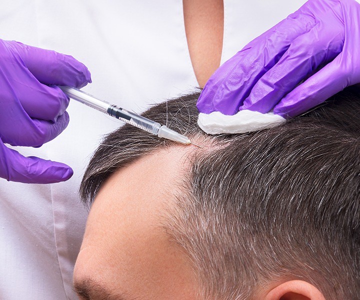 Trained professional performing PRP Hair Restoration.
