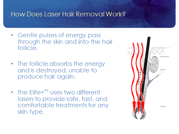 laser hair removal ogden